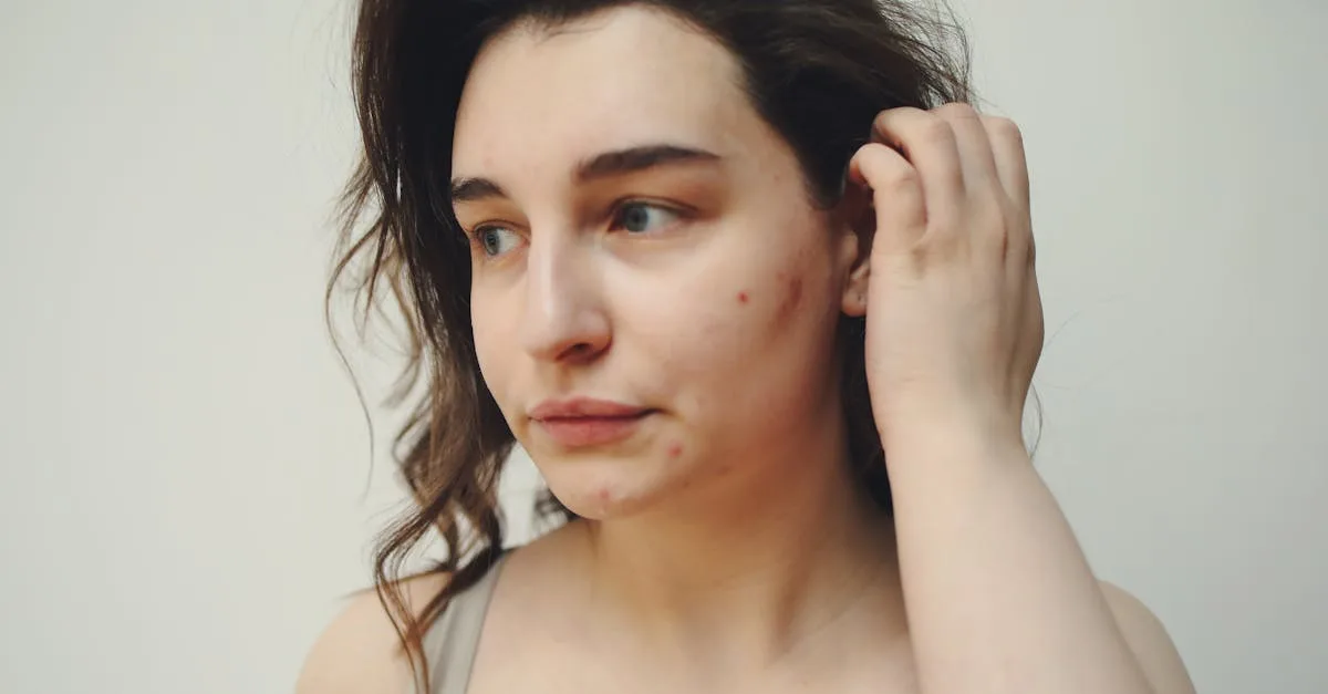 découvrez nos conseils et produits efficaces pour prendre soin de votre peau acnéique et retrouver un teint clair et sain.